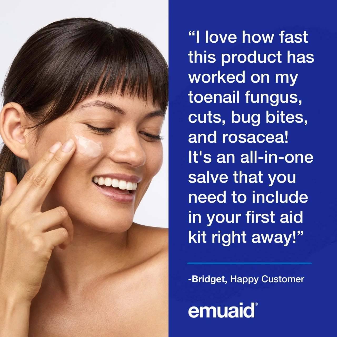 emuaid EMUAIDMAX Ointment for Itchy Skin, Maximum Strength Treatment for Athlete's Foot, Psoriasis, Jock Itch, Rash, Eczema, Cold Sores, Blisters,